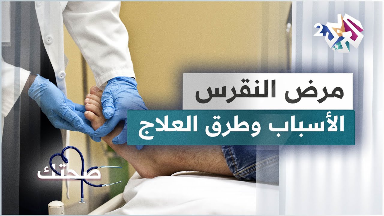 مرض النقرس | التشخيص وطرق العلاج
