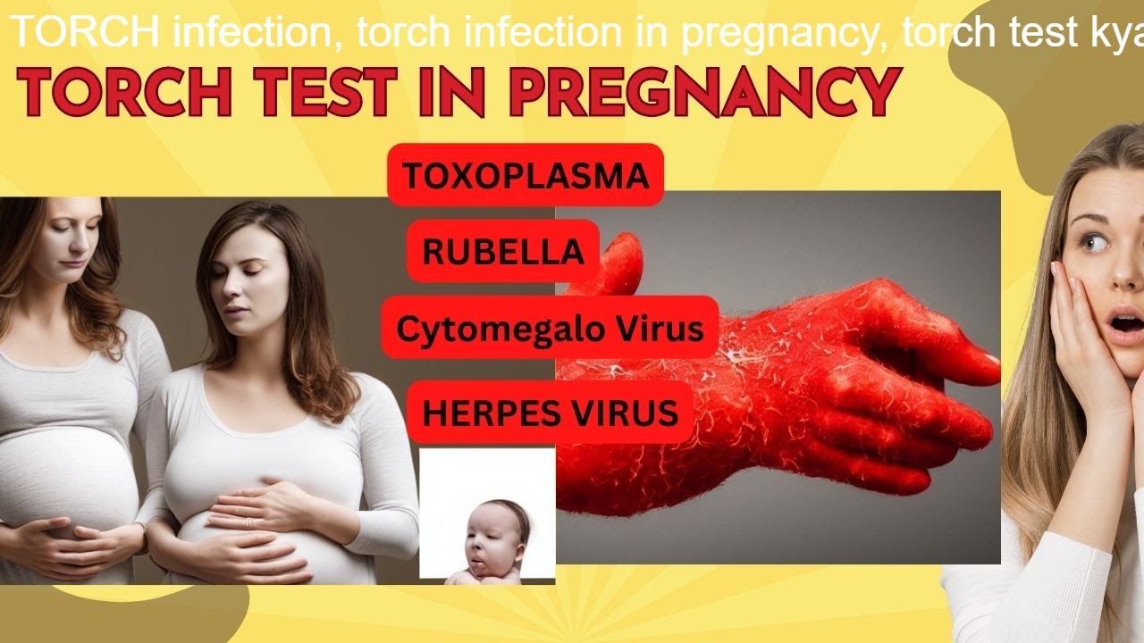 TORCH Infection: Are You at Risk?  Find Out Now #torchinfection #rubella #toxoplasmagondii