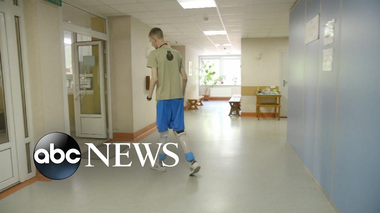 Demand for artificial limbs surges in Ukraine since Russian invasion