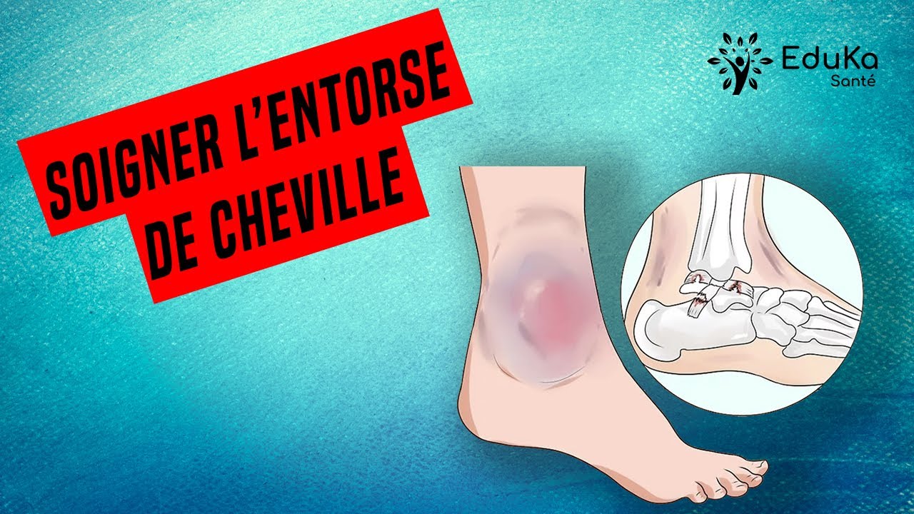 SOIGNER L'ENTORSE DE CHEVILLE [Conseils et exercices]