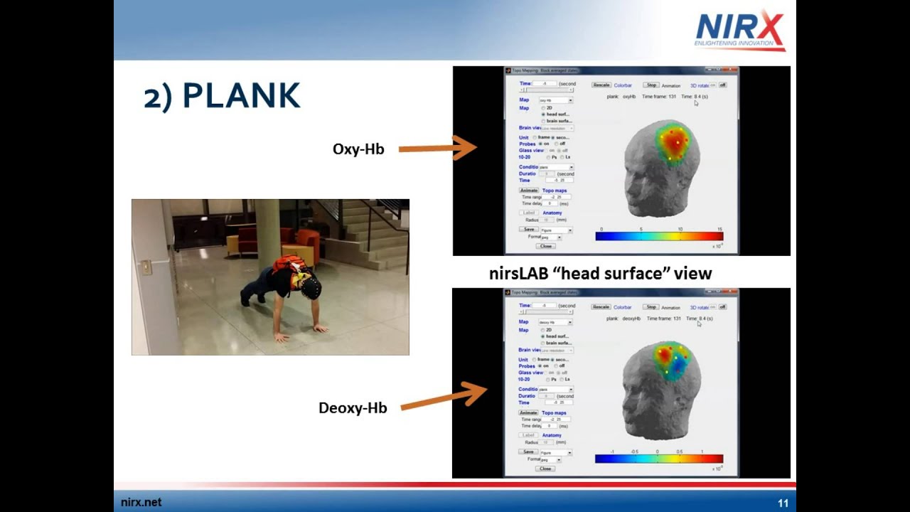 NIRS - NIRSport - Overview of NIRS Performance with Motion