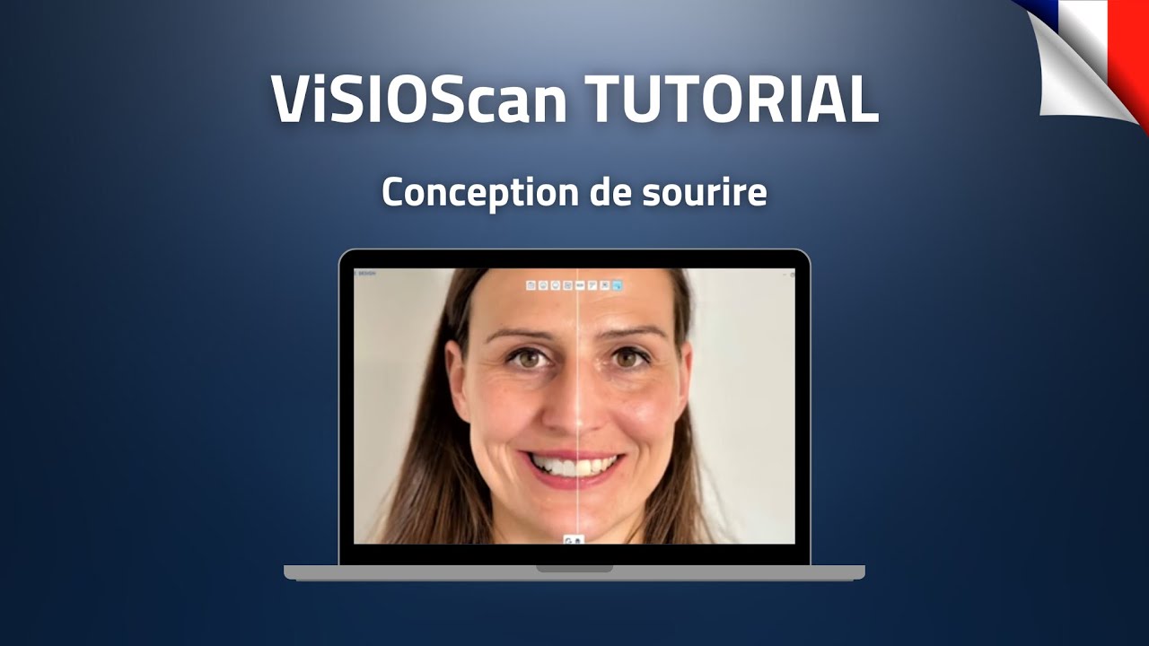 4_Conception de sourire