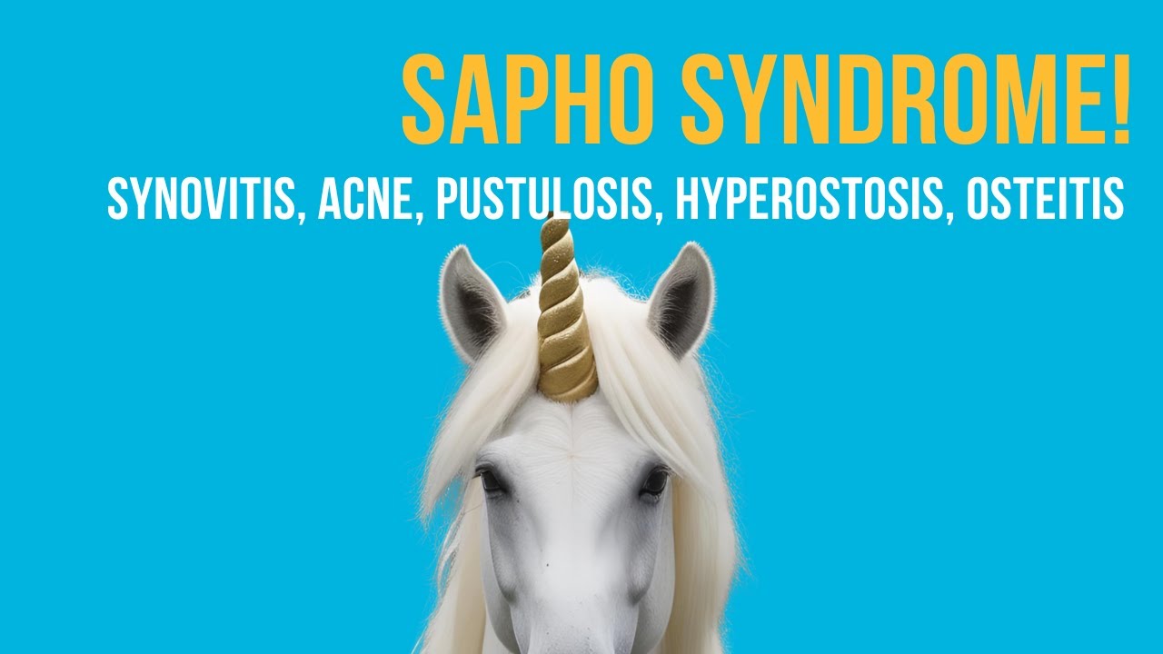 SAPHO Syndrome Explained – Symptoms, Causes & Treatment