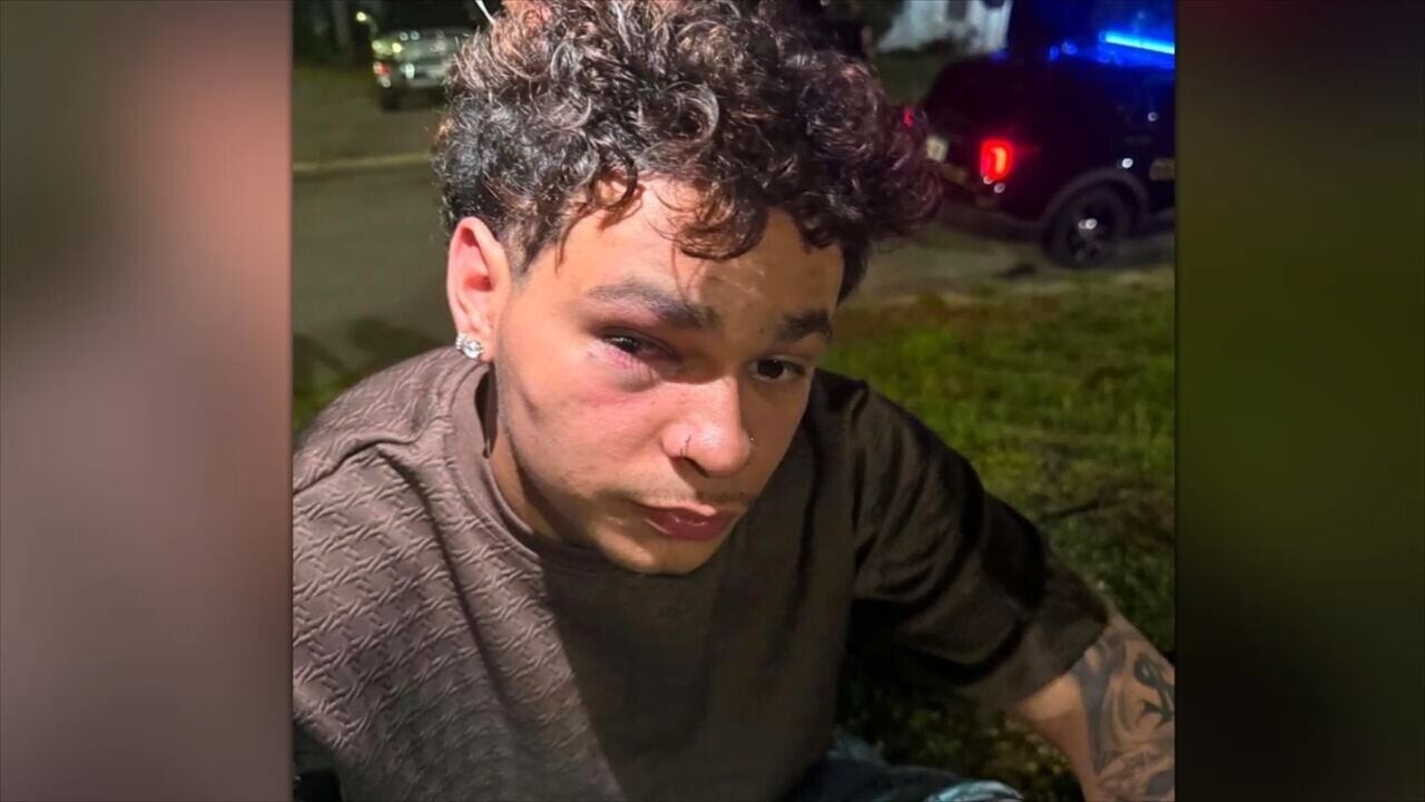 Man beaten by 12 people, including 14-year-old, after fender bender, police say