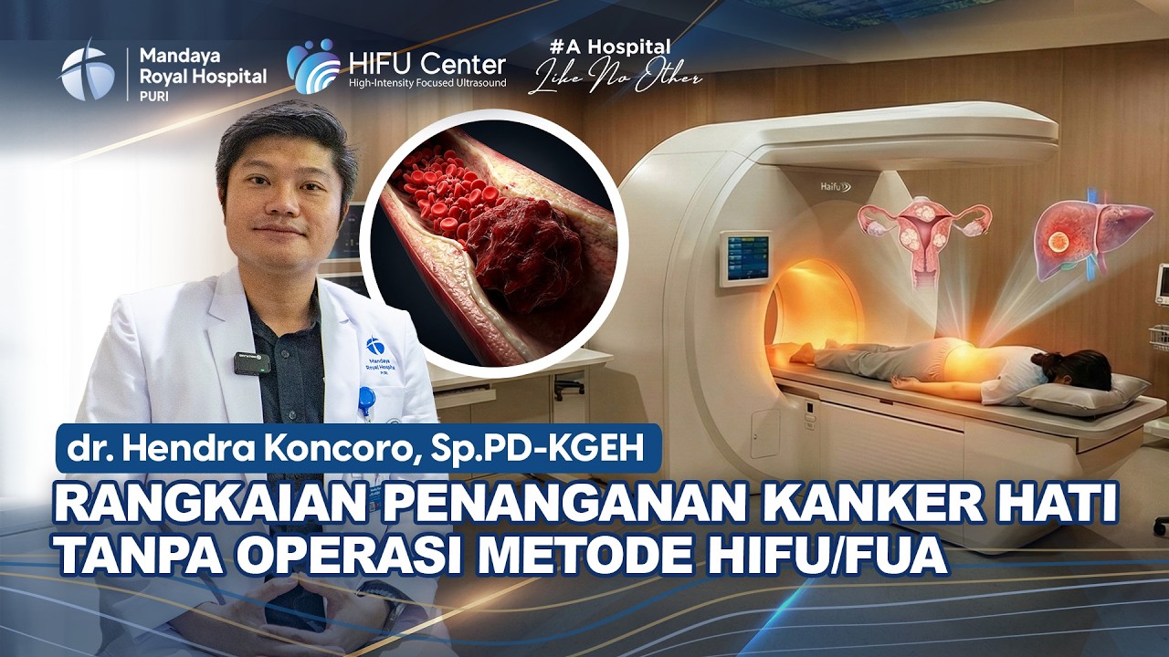 Langkah Penanganan Kanker Hati Metode HIFU / FUA | dr. Hendra Koncoro, Sp.PD-KGEH