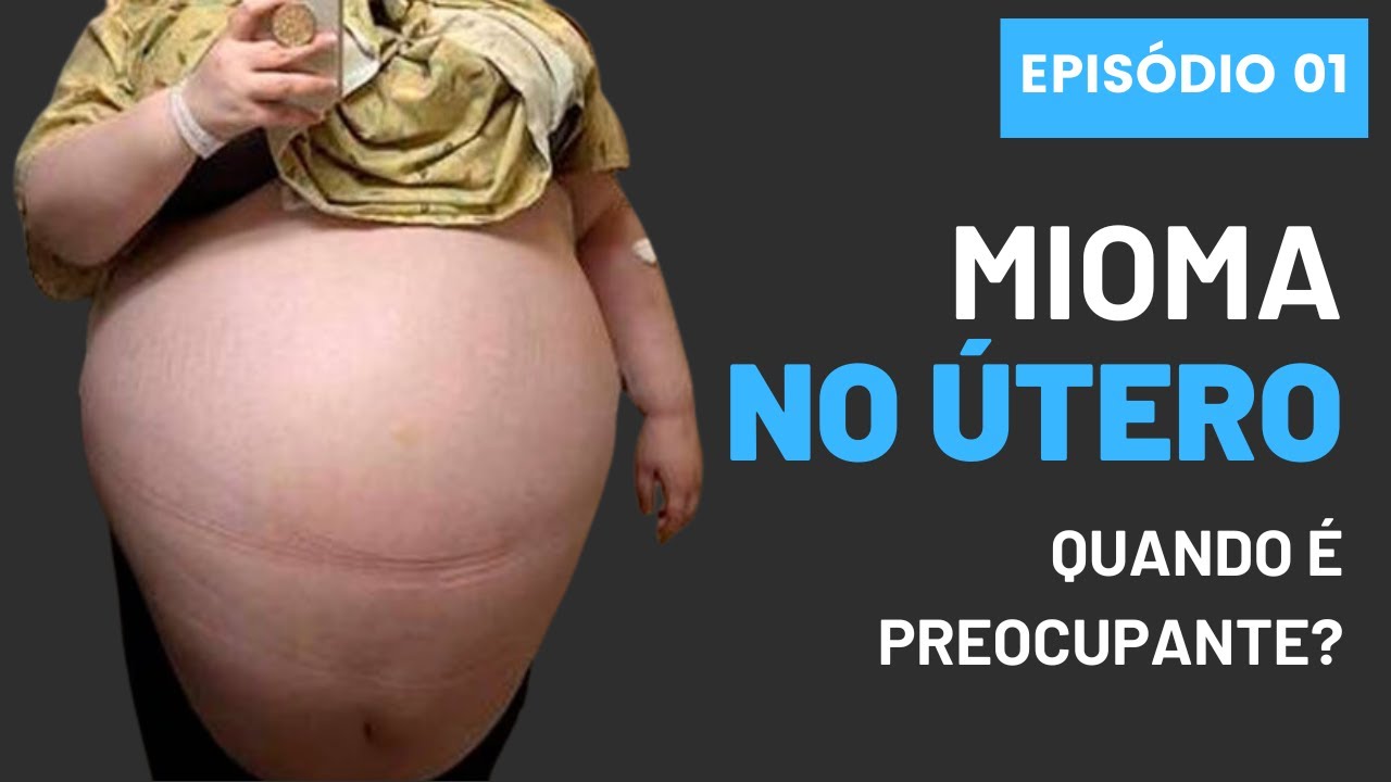 MIOMA UTERINO:
