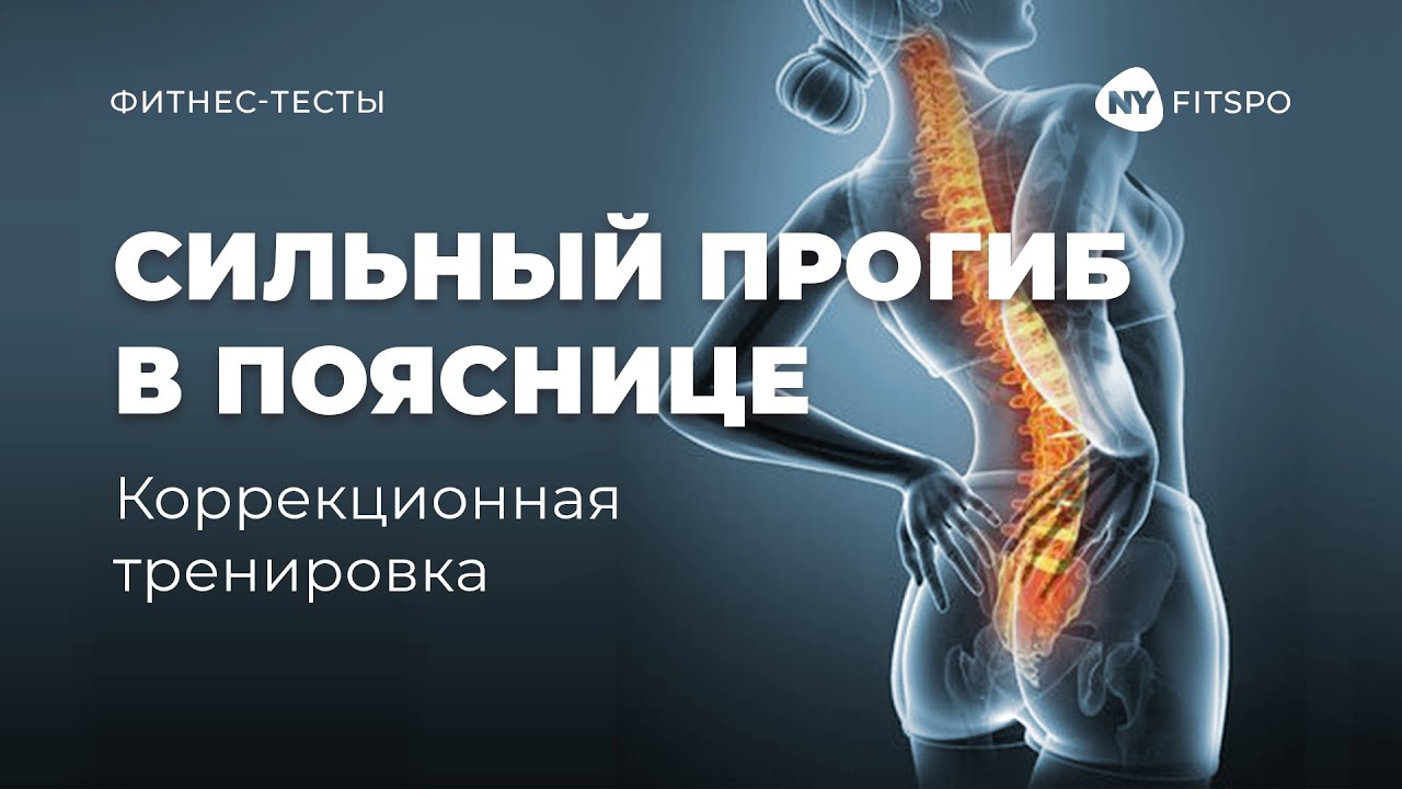 Исправляем осанку | КОМПЛЕКС УПРАЖНЕНИЙ при ГИПЕРЛОРДОЗЕ| Тест на гиперлордоз в домашних условиях