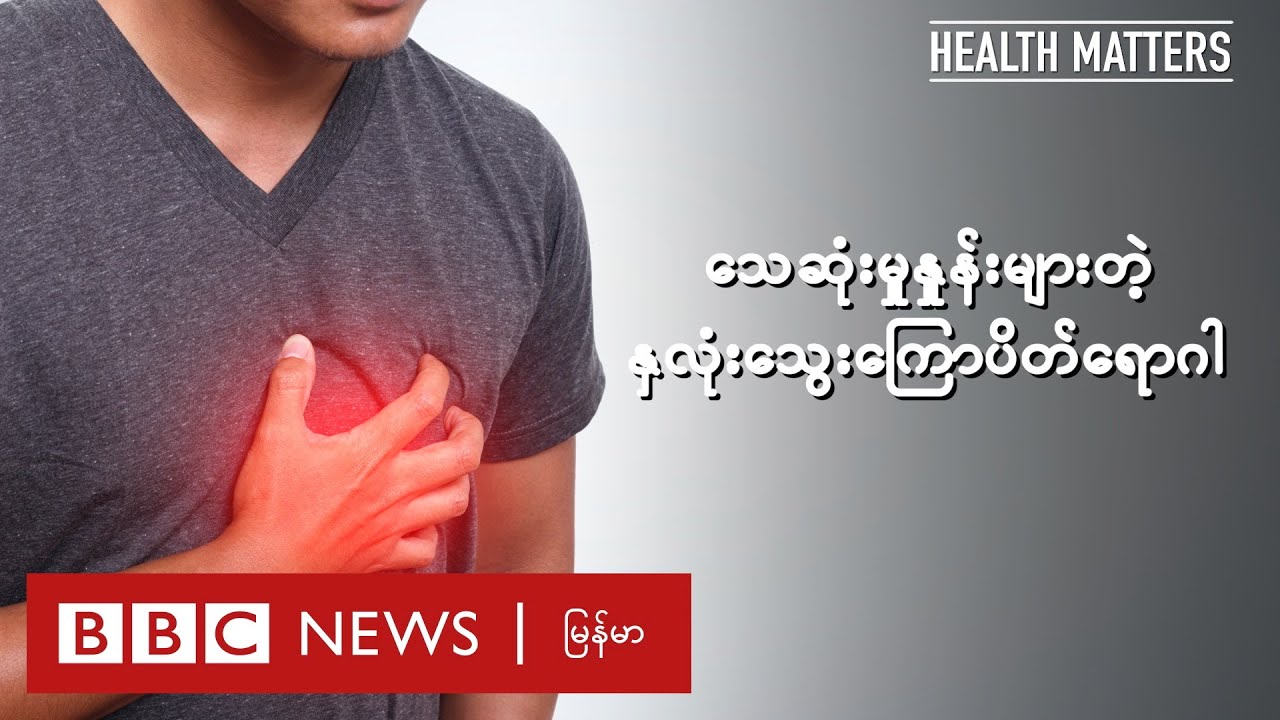 လူဆယ်ယောက်မှာတစ်ယောက် အသက်ဆုံးတဲ့ နှလုံးသွေးကြောကျဉ်းရောဂါ - BBC News မြန်မာ