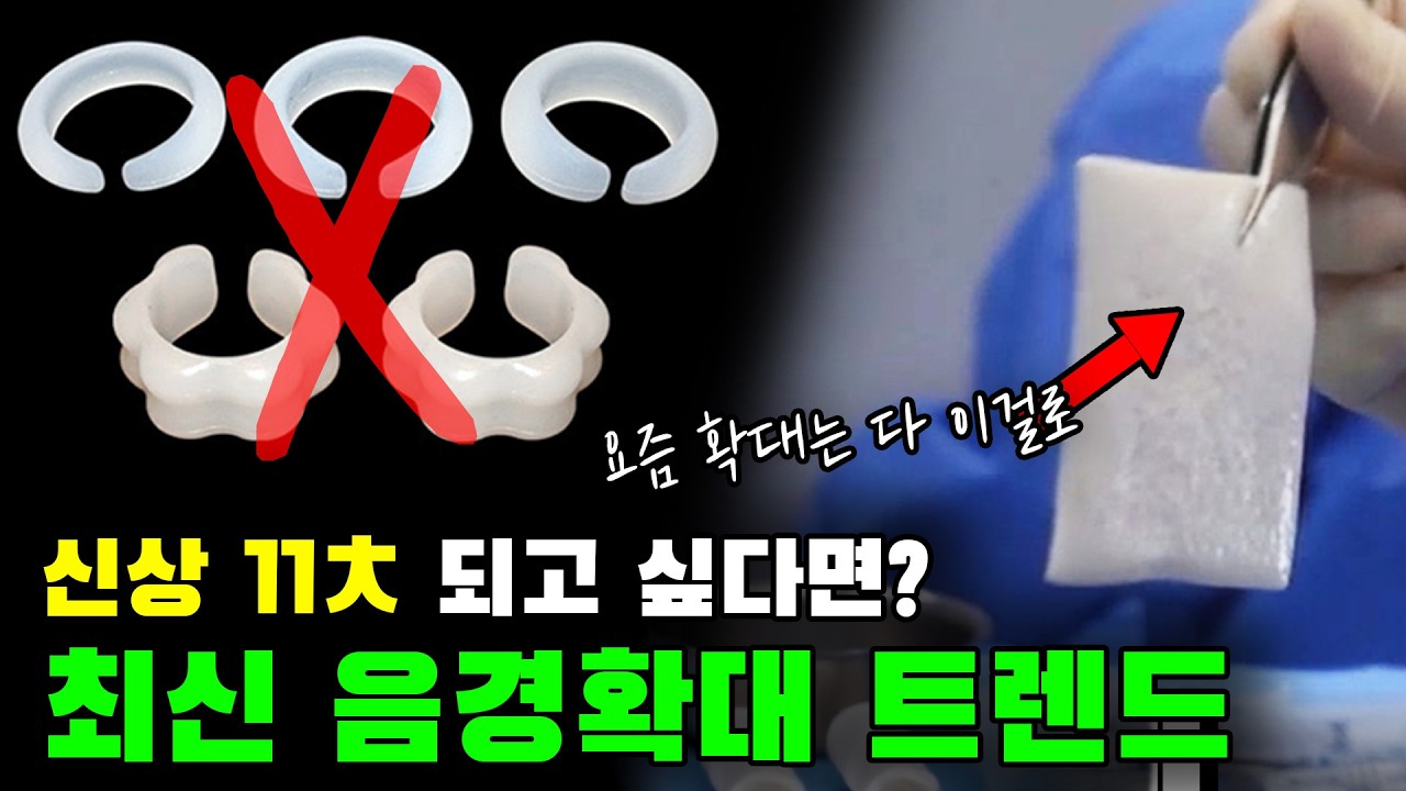 음경확대, 요즘은 이렇게 합니다 ※음경확대 최신 트렌드 정리※