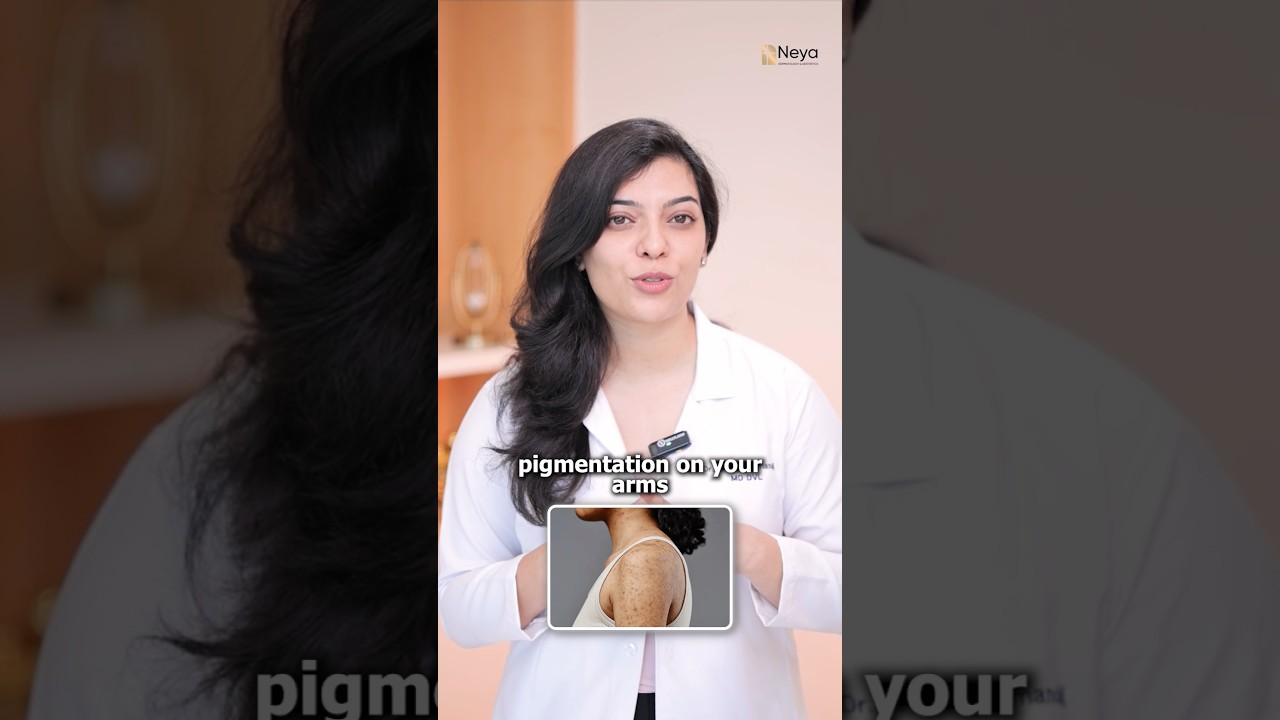 Dark pigmentation on arms | Causes of pigmentation #shorts #pigmentation