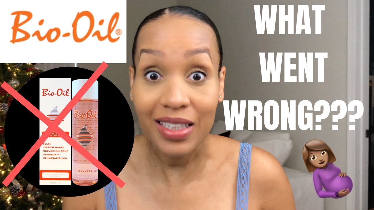 My BIO OIL Horror Story | Stretch Mark Oil | Pregnancy Diaries