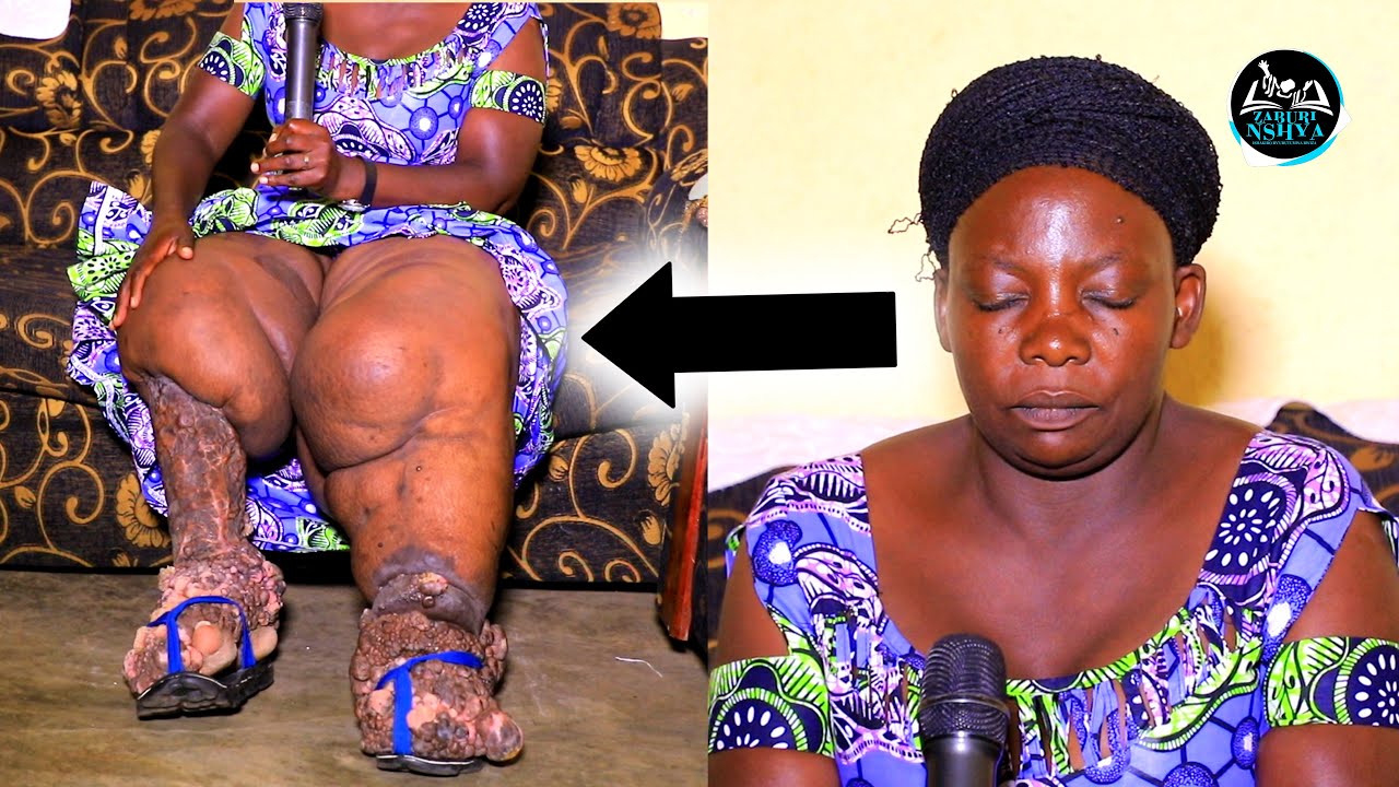 Ni Uku Imana iteye😭 Bakobwa Mwumve ibi💔 Bavuga Ko Aya maguru Nayatanze IKUZIMU bampa UBUTUNZI😢 SARAH