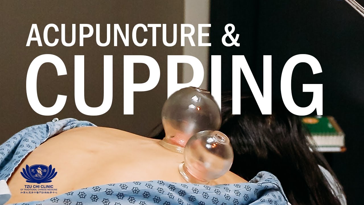 Trying Chinese medicine for the first time