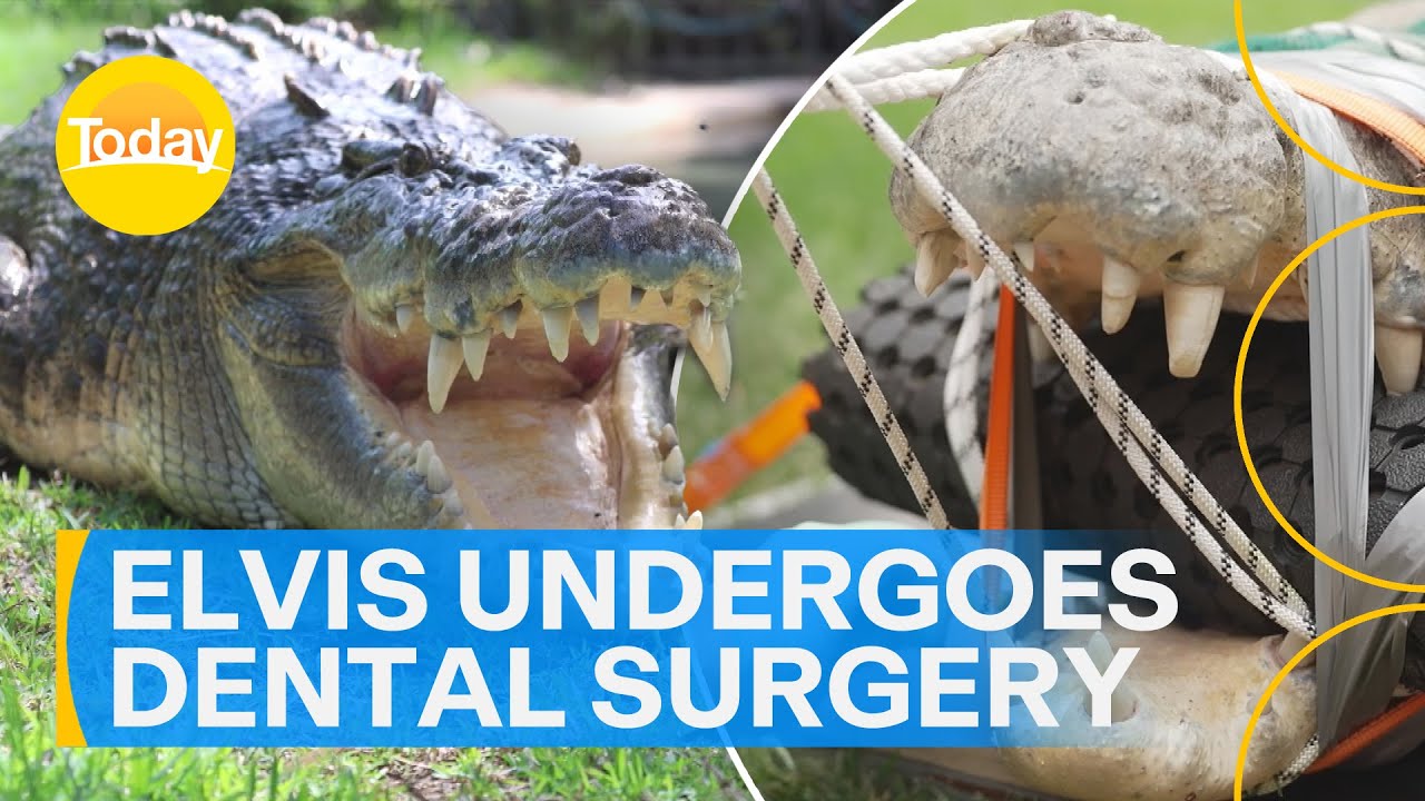 Elvis the five-metre croc undergoes detailed dental surgery | Today Show Australia