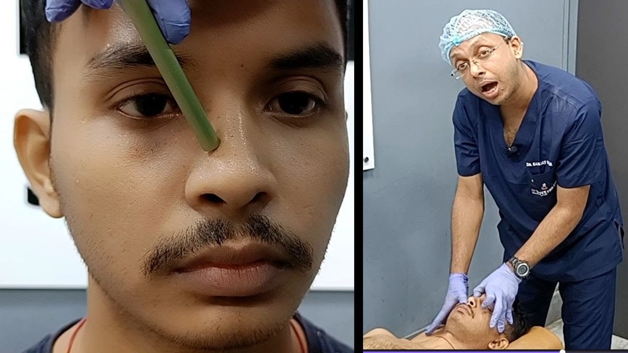 College Goer Faces Breathlessness due to DEVIATED NASAL SEPTUM - CHIROPRACTIC Care for Relief