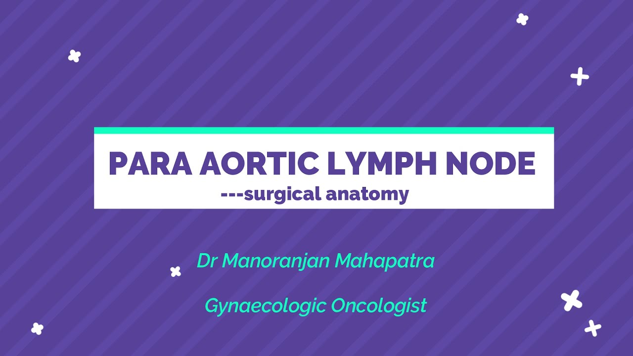 PARA AORTIC LYMPH NODES -SURGICAL ANATOMY /# PALN /# PARA AORTIC LYMPHADENECTOMY /# LYMPHADENECTOMY