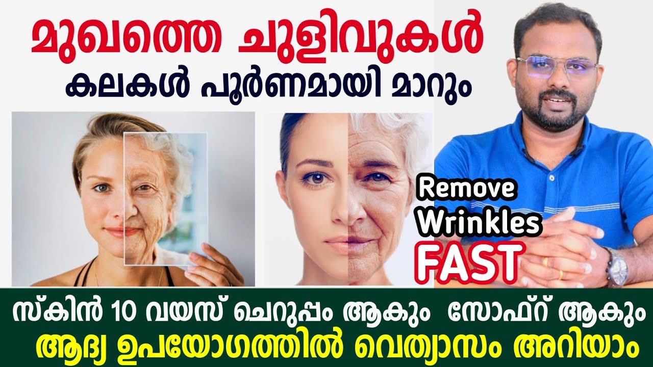 മുഖത്തെ ചുളിവുകൾ മാറ്റാൻ ഇങ്ങനെ ചെയ്താൽ മതി | How to get rid of face wrinkles at home malayalam