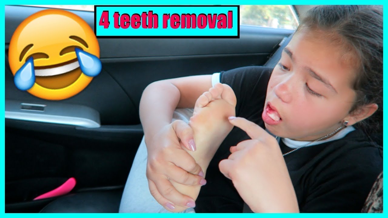 FUNNY REACTION AFTER 4 TEETH REMOVAL WITH LAUGHING GAS 😂🤣🤪 #205