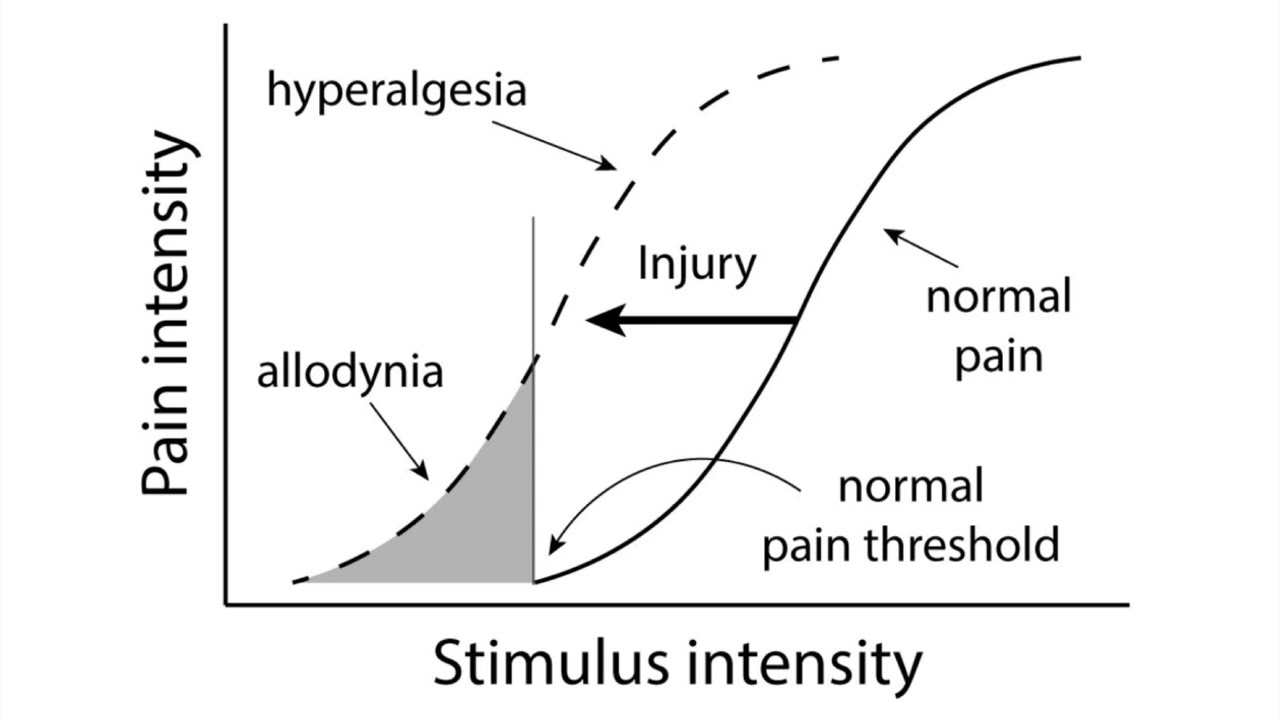 Douleur : l’hyperalgésie et l’allodynie - Douleurs chroniques, fibromyalgie, migraines, SDRC, etc