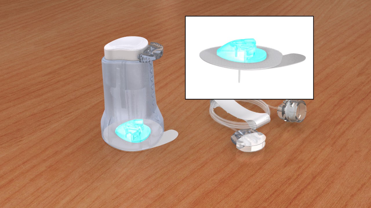 MiniMed™ Infusion Sets – Mio™ Advance