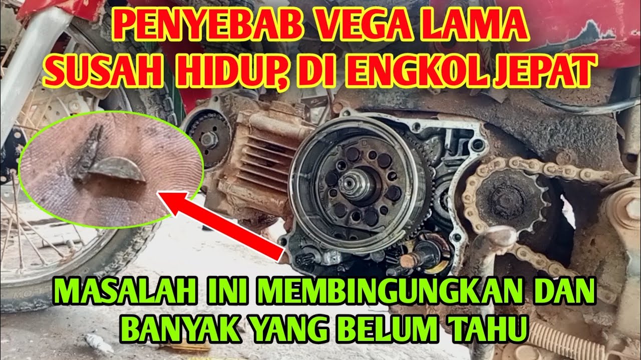 PENYEBAB VEGA LAMA SUSAH HIDUP- PENYAKIT LANGKA
