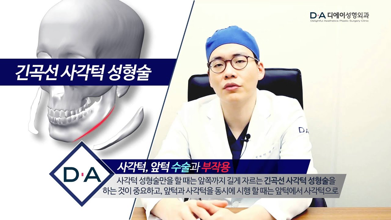 디에이성형외과 사각턱,앞턱 수술과 주의사항에 대해