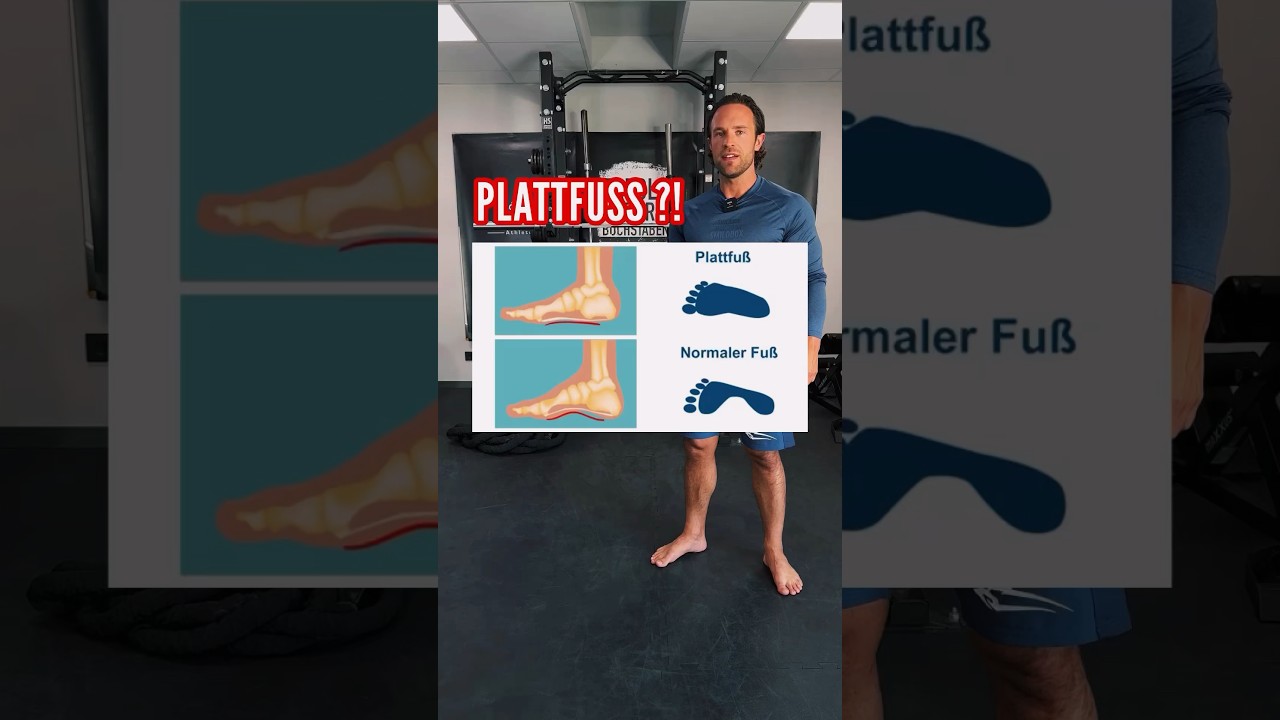 🔺PLATTF&Uuml;SSE🔺MACH DIESE EINFACHE &Uuml;BUNG JEDEN TAG!