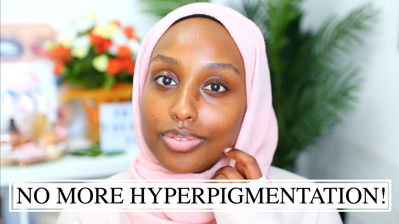 HOW I GOT RID OF MY HYPERPIGMENTATION & DARK MARKS! | Aysha Abdul