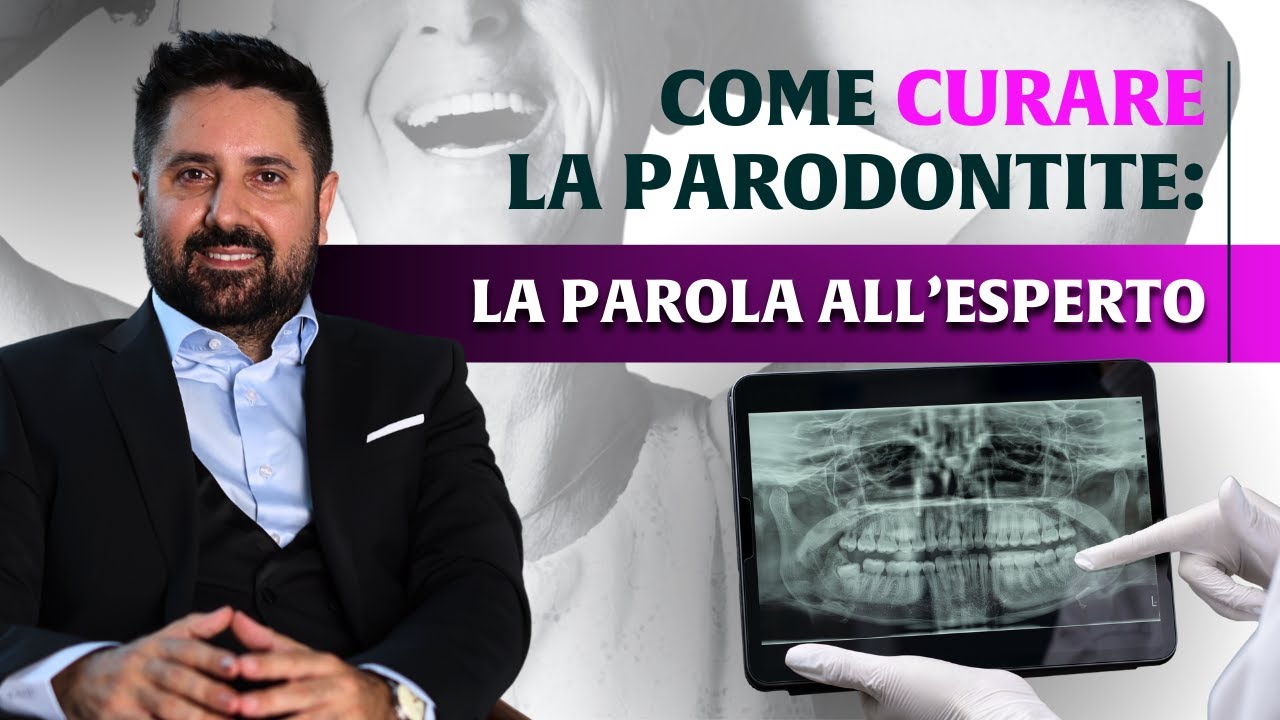 Il Sistema Bocca Bionica: La Soluzione Definitiva per la Parodontite