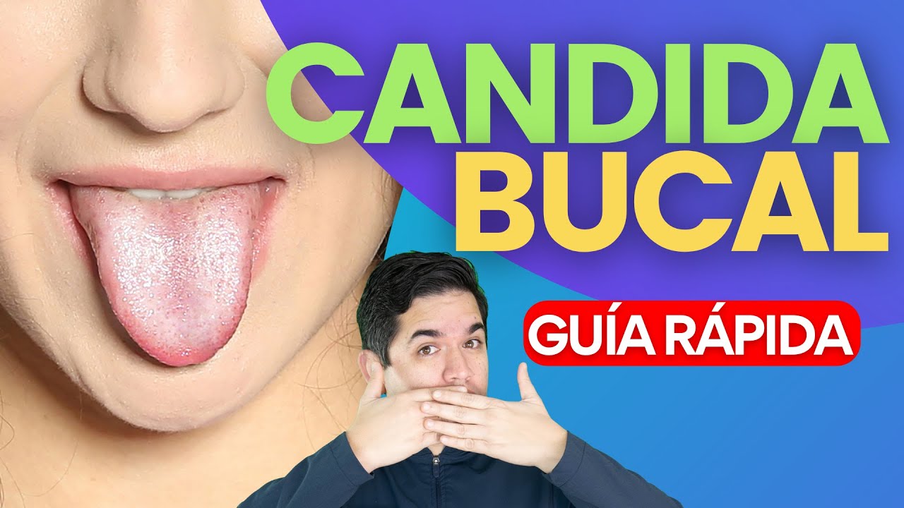 Combate La CANDIDIASIS BUCAL 🦷👀👅