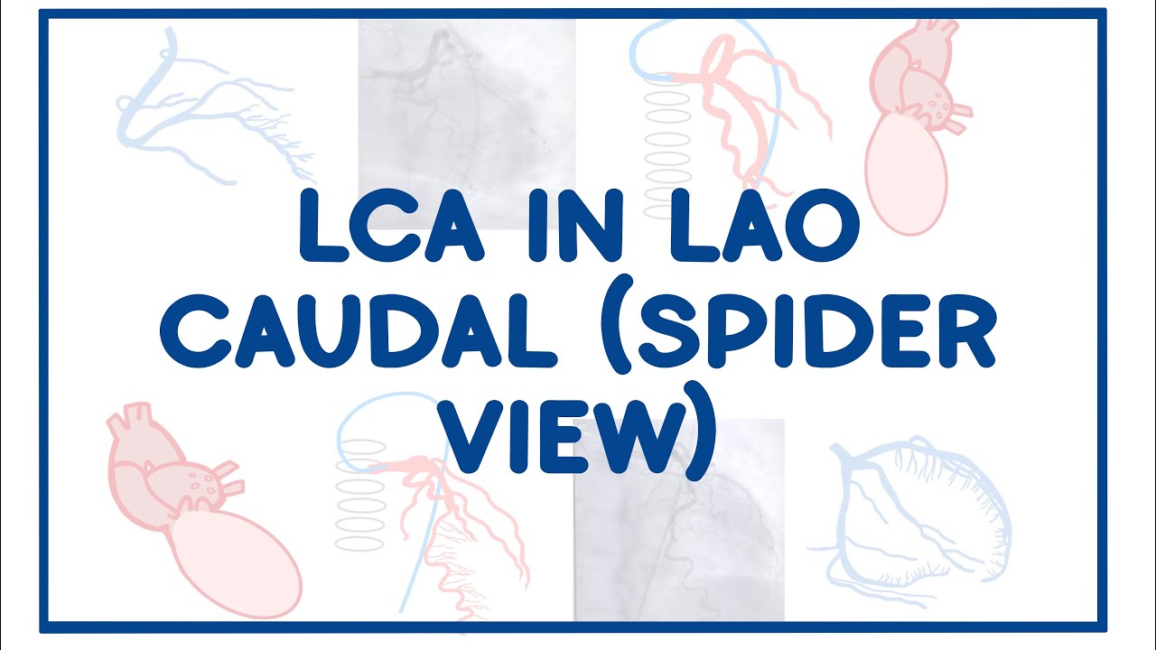 LAO CAUDAL - Spider View
