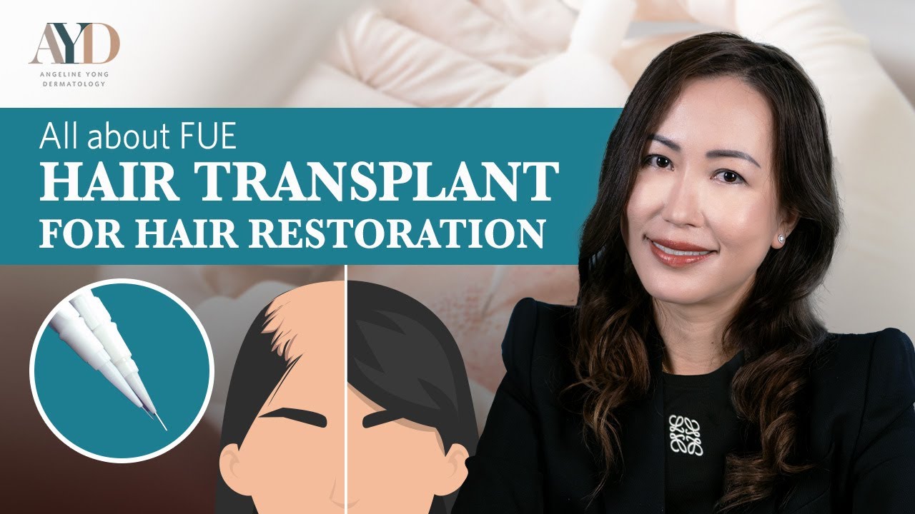 All about FUE Hair Transplant For Hair Restoration