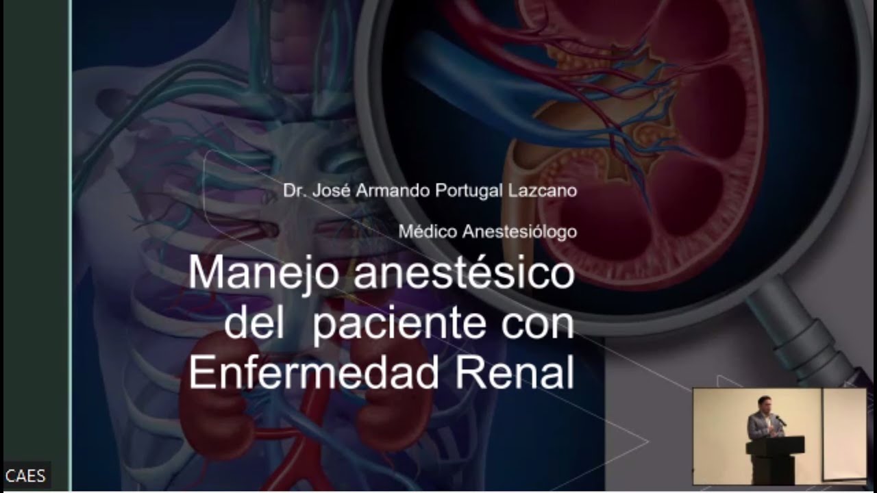 Manejo anestésico del paciente con enfermedad renal. Dr. José Armando  Portugal Lazcano