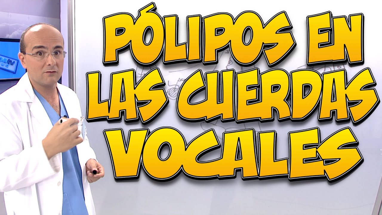 PÓLIPOS EN LAS CUERDAS VOCALES