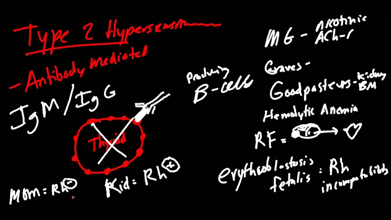 Hypersensitivity Reactions Made Simple!