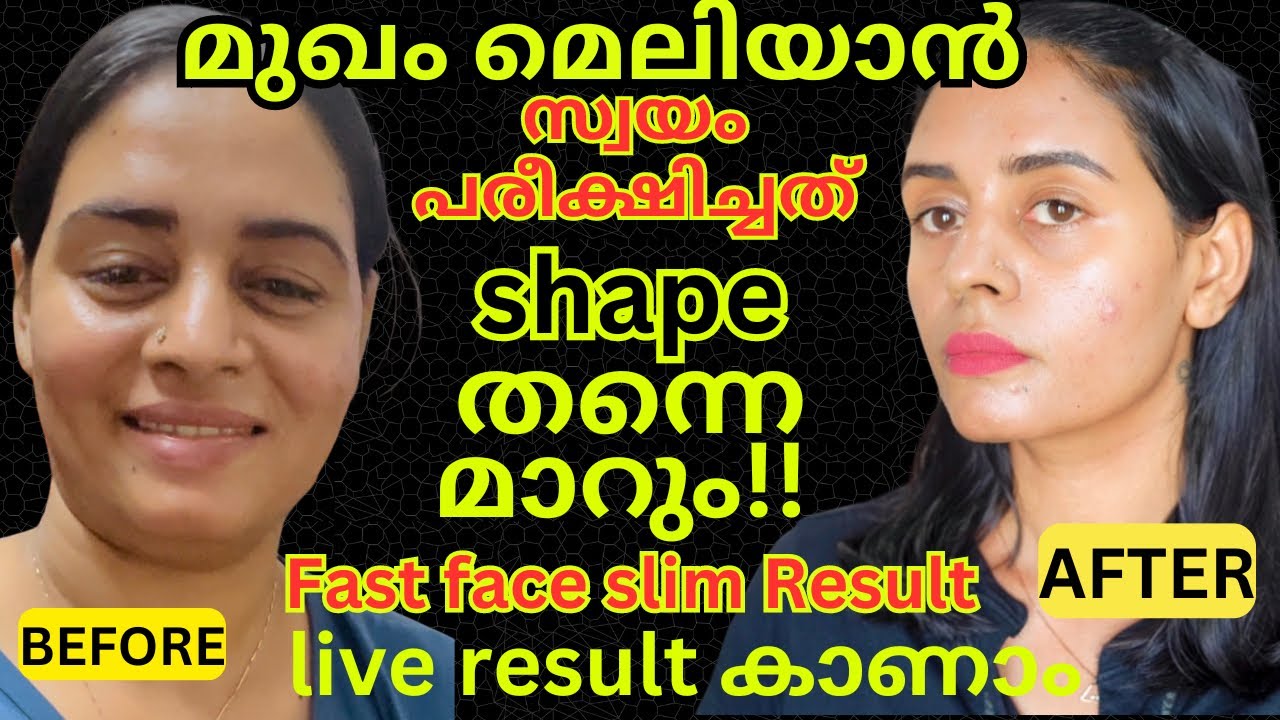 സ്വയം പരീക്ഷിച്ചു വിജയിച്ച റിസൾട്ട്‌👀മുഖംമെലിഞ്ഞു shape ആകാൻ എളുപ്പമാർഗം|| fast face fat reduce