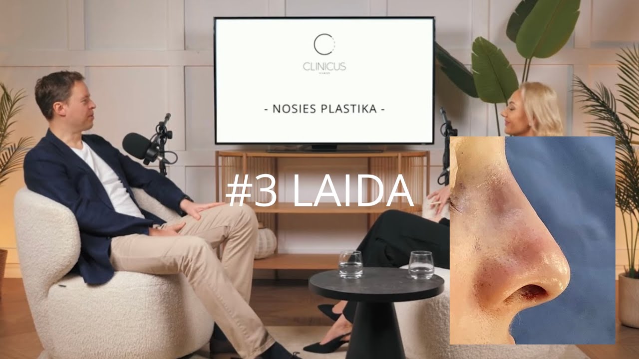 #3 Nosies plastika I Grožis reikalauja išmanymo |