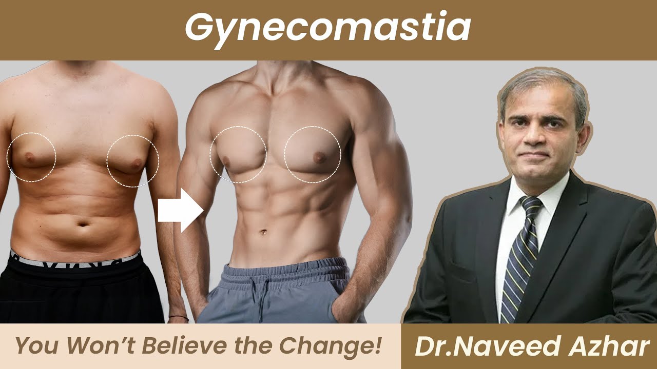 Secrets of Gynecomastia Surgery Mardana Chaati Ka Ilaj Symptoms & Treatment of Enlarged Male Breast