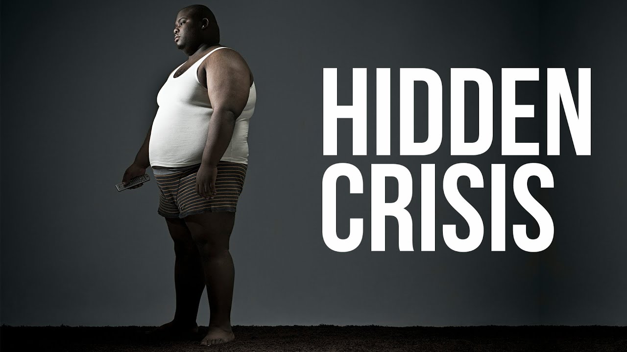 Thiamine Deficiency: The Hidden Epidemic Affecting Obesity and Diabetes