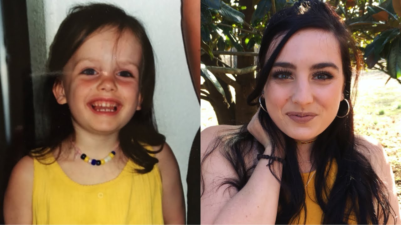 I HAVE A RARE DISEASE AND IT ALMOST KILLED ME (My Story)