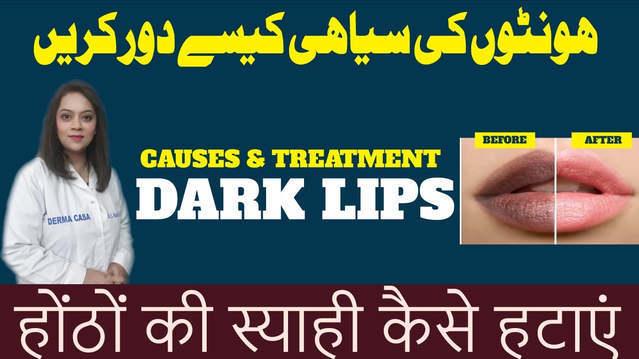 Dark Lips | Causes & Treatment | Dr. Batool Ashraf