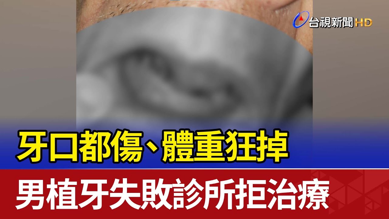 牙口都傷、體重狂掉 男植牙失敗診所拒治療