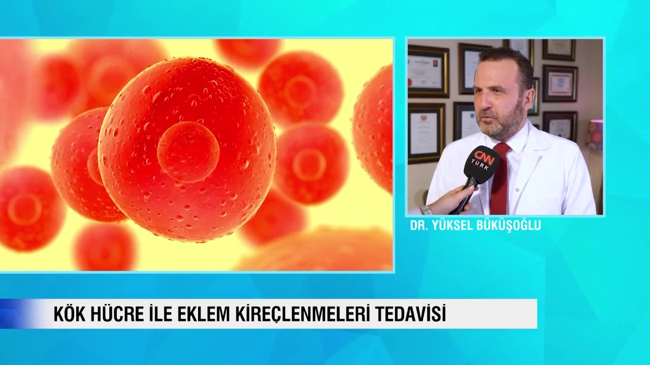 Ameliyatsız, Protez Gerektirmeden Diz Kireçlenmesi Tedavisi, Dize Kök Hücre Tedavisi - ORTOCELL