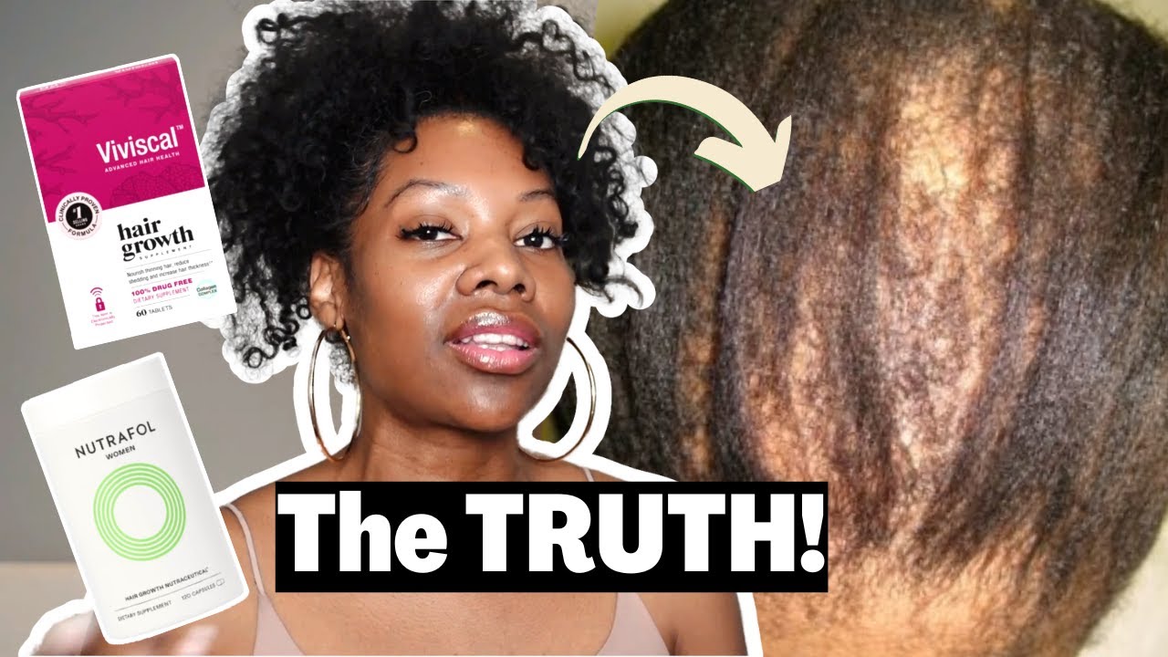 Hair Growth Supplements for Natural Hair: Will My HAIR FALLOUT If I Stop Taking Hair Supplements?
