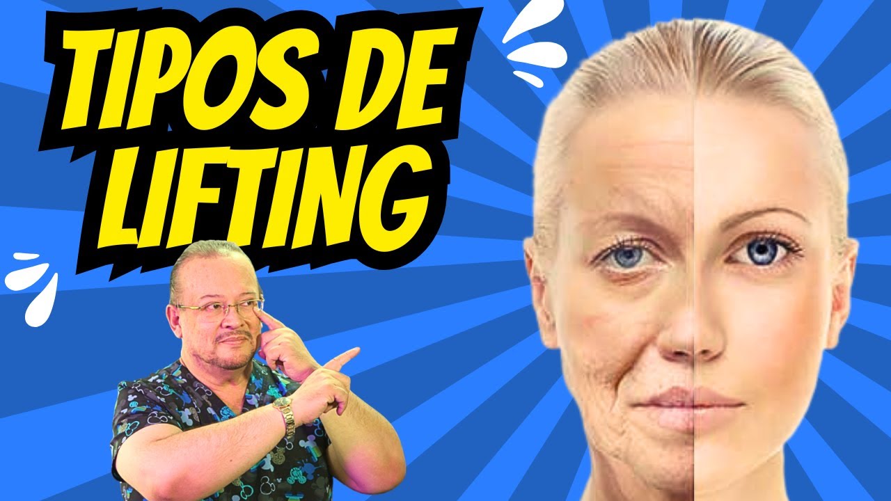 Lifting facial moderno vs tradicional: ¿Qué tipo te conviene?