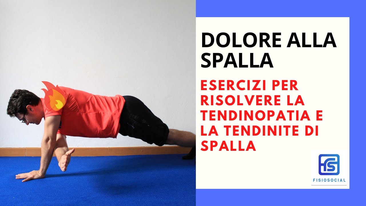 Tendinite spalla: strategie ed esercizi riabilitativi per risolverla