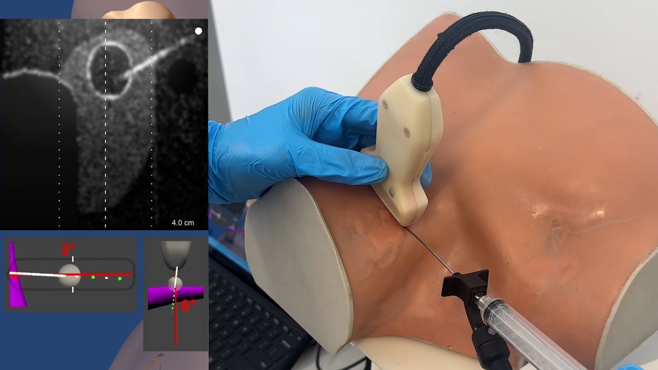 CSSALT - Thyroid Biopsy