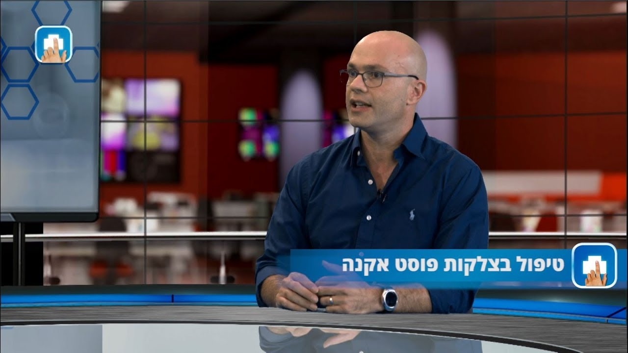 טיפול בצלקות פוסט אקנה- ד