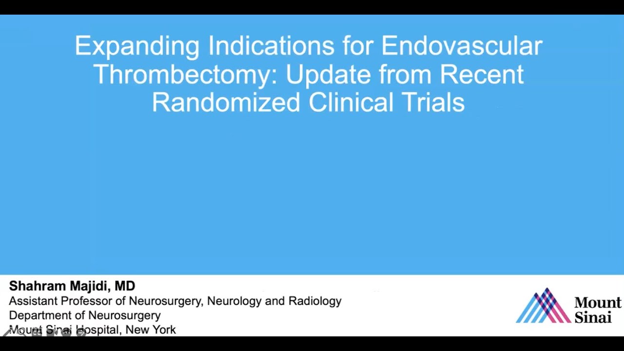 Expanding Indications for Endovascular Thrombectomy: Update from Recent Randomized Clinical Trials