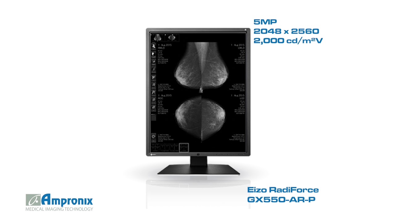 Eizo RadiForce GX550-AR-P Display Monitor Screen Sales | Service | Repair | Exchange | Replacement